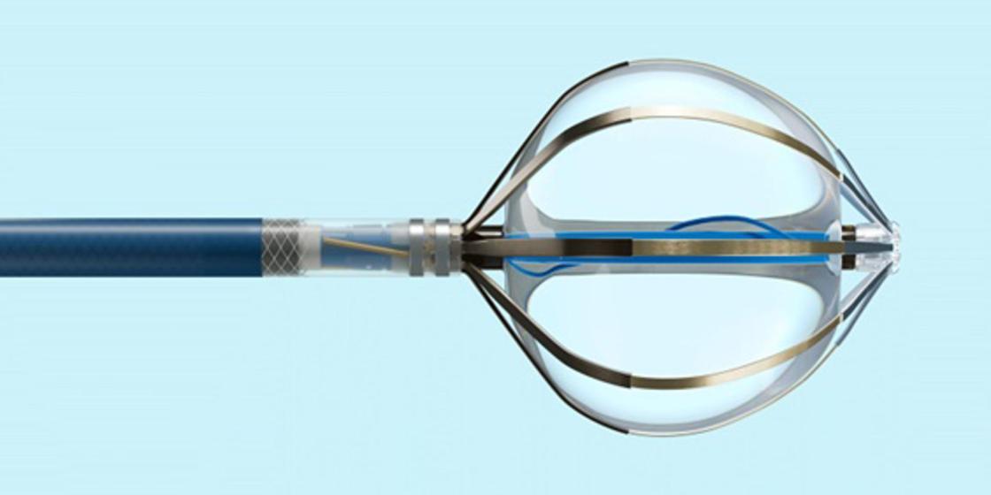 El sistema de ablación por campo pulsado de Abbott, disponible en España para tratar las arritmias cardíacas